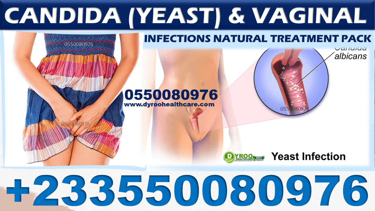 CANDIDA-VAGINAL INFECTIONS